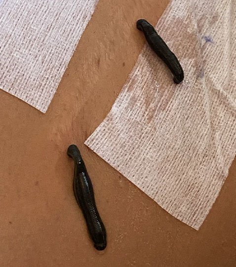 Les contre-indications