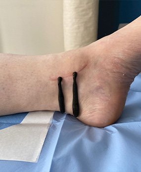 De l'outil Thérapeutique Traditionnel à la Reconnaissance Médicale Moderne - 2