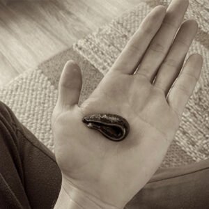 Séance D'hirudothérapie